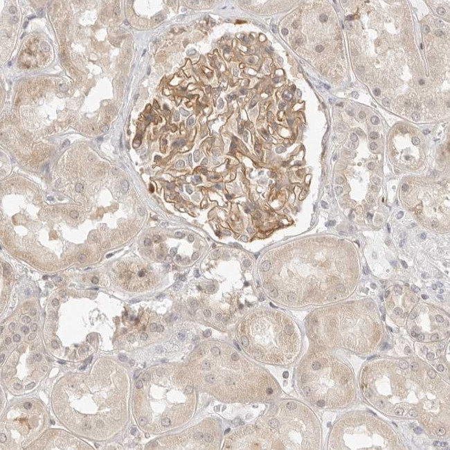 TCP1 Antibody in Immunohistochemistry (Paraffin) (IHC (P))