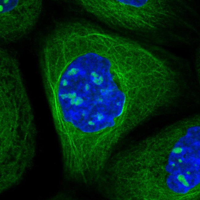 MEK5 Antibody in Immunocytochemistry (ICC/IF)