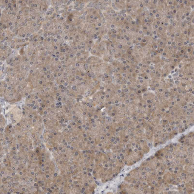 HTRA2 Antibody in Immunohistochemistry (Paraffin) (IHC (P))