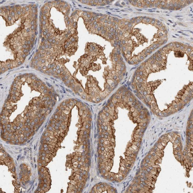 BAIAP2 Antibody in Immunohistochemistry (Paraffin) (IHC (P))