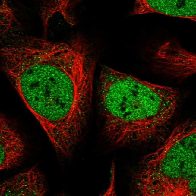 ZEB1 Antibody in Immunocytochemistry (ICC/IF)