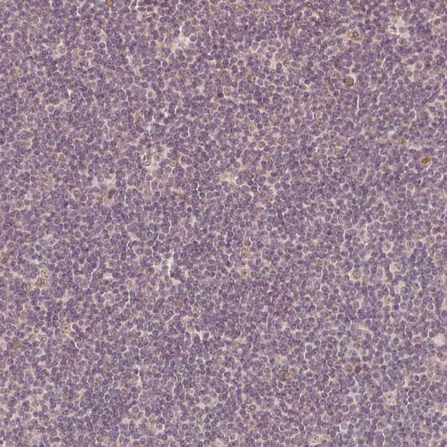 ZMAT3 Antibody in Immunohistochemistry (Paraffin) (IHC (P))