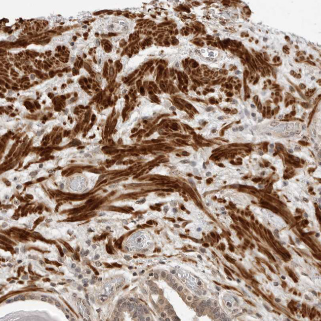 MEK5 Antibody in Immunohistochemistry (Paraffin) (IHC (P))