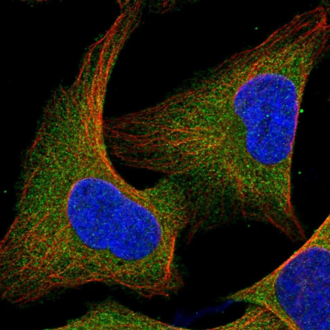 c-Cbl Antibody in Immunocytochemistry (ICC/IF)