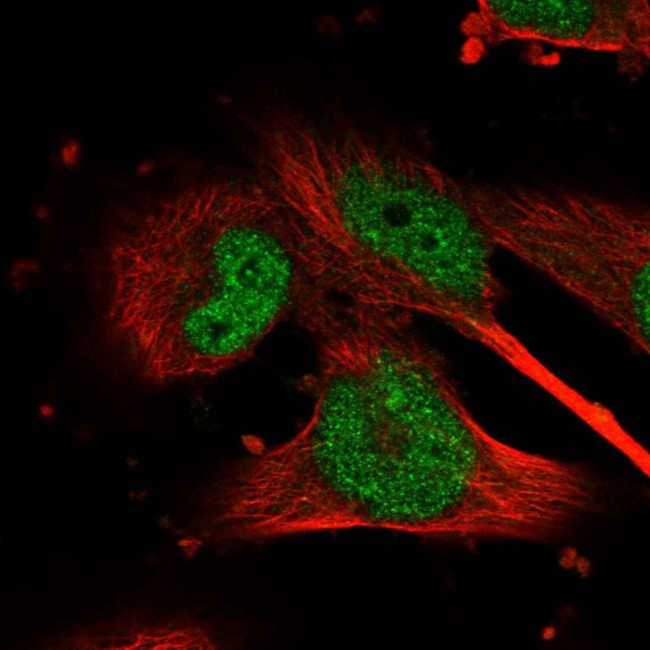 GSK3B Antibody in Immunocytochemistry (ICC/IF)