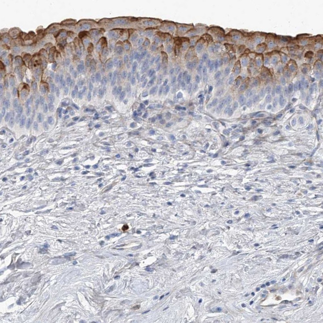 LIMK1 Antibody in Immunohistochemistry (Paraffin) (IHC (P))