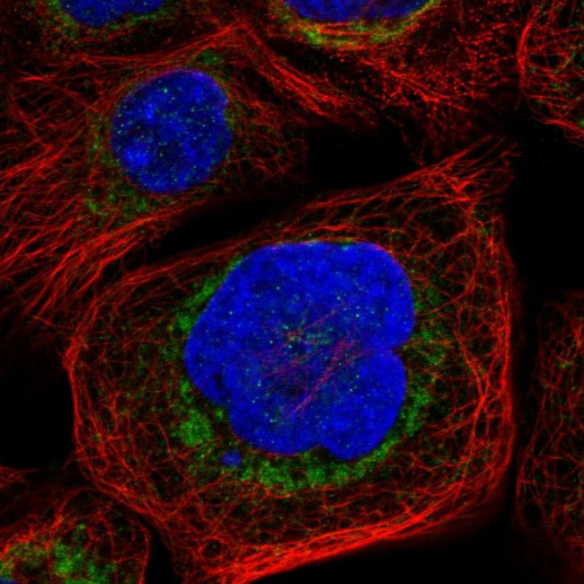 BAD Antibody in Immunocytochemistry (ICC/IF)