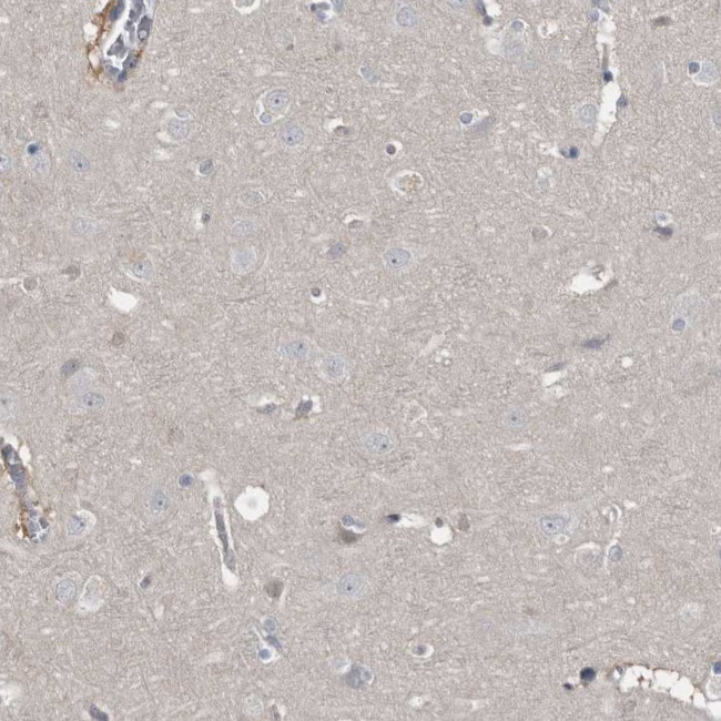 RBKS Antibody in Immunohistochemistry (Paraffin) (IHC (P))