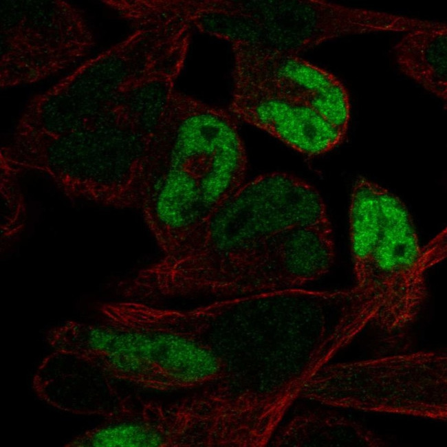 Myogenin Antibody in Immunocytochemistry (ICC/IF)