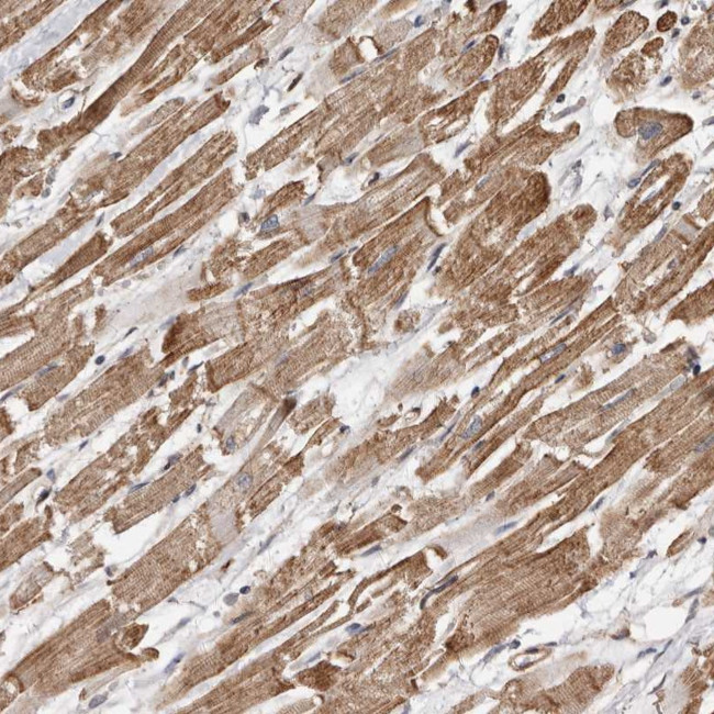 GSK3 alpha Antibody in Immunohistochemistry (Paraffin) (IHC (P))