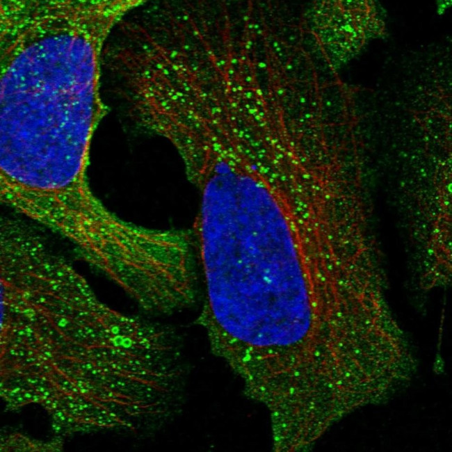 CSK Antibody in Immunocytochemistry (ICC/IF)