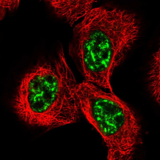 WRN Antibody in Immunocytochemistry (ICC/IF)