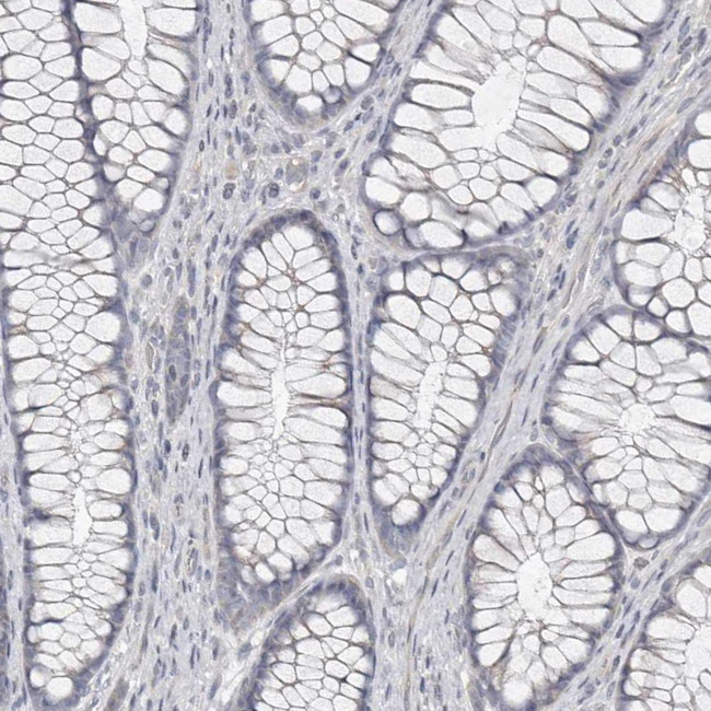 Carbonic Anhydrase VI Antibody in Immunohistochemistry (Paraffin) (IHC (P))