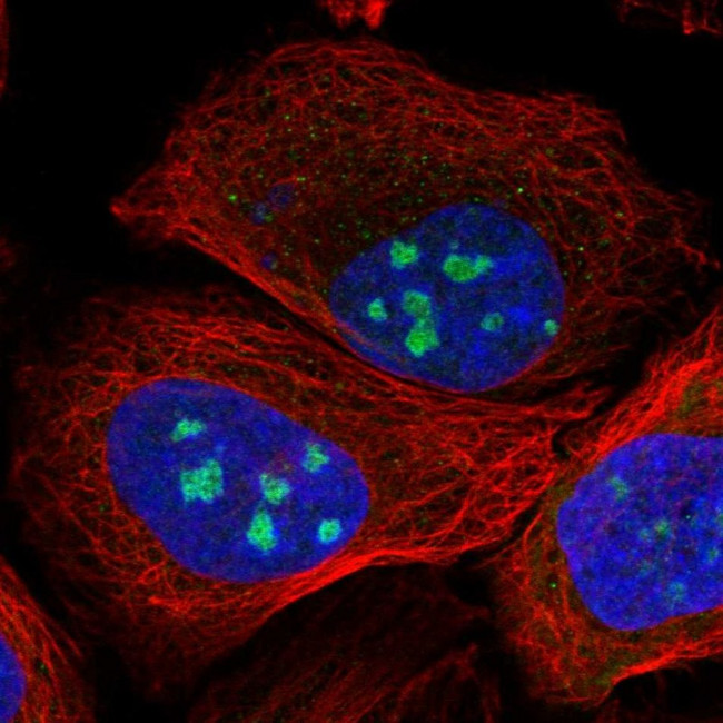 Bisphosphoglycerate mutase Antibody in Immunocytochemistry (ICC/IF)