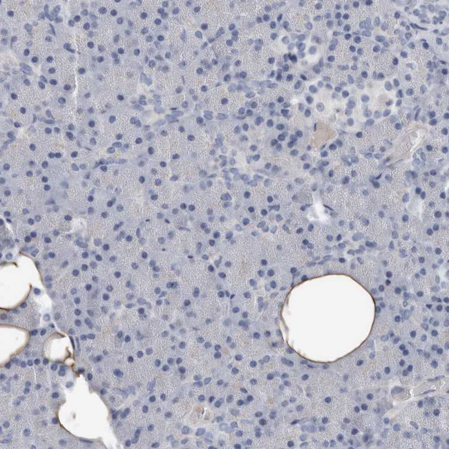 FABP7 Antibody in Immunohistochemistry (Paraffin) (IHC (P))