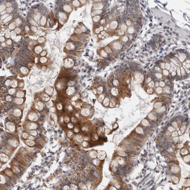 MOGAT2 Antibody in Immunohistochemistry (Paraffin) (IHC (P))