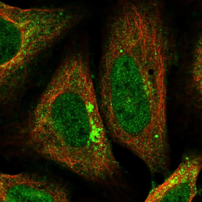 AP2 alpha Antibody in Immunocytochemistry (ICC/IF)