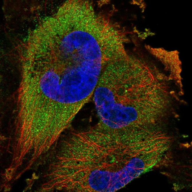 HIP2 Antibody in Immunocytochemistry (ICC/IF)