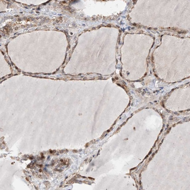 PPAP2B Antibody in Immunohistochemistry (Paraffin) (IHC (P))