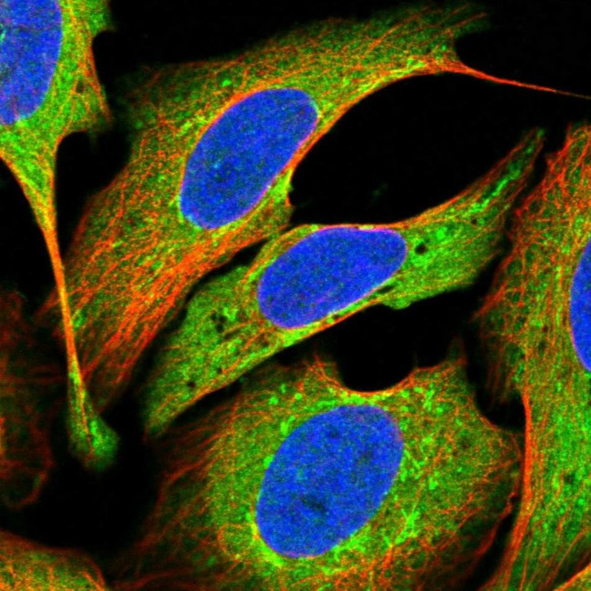 SMYD2 Antibody in Immunocytochemistry (ICC/IF)