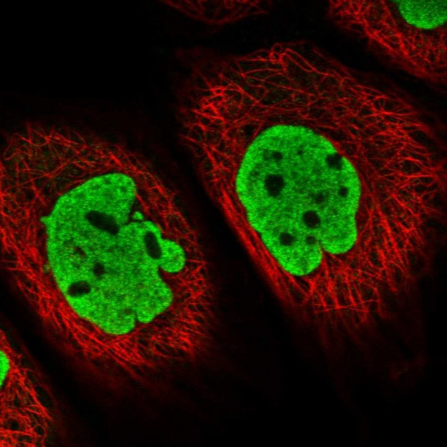 V-ATPase E1 Antibody in Immunocytochemistry (ICC/IF)