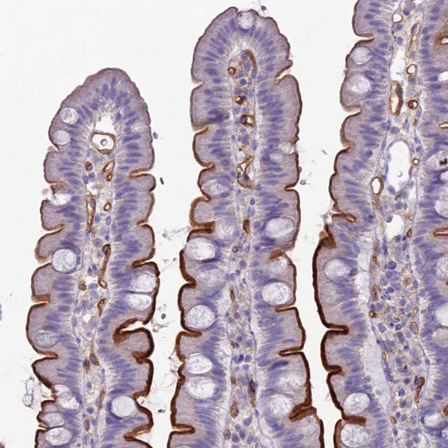 ACE Antibody in Immunohistochemistry (Paraffin) (IHC (P))