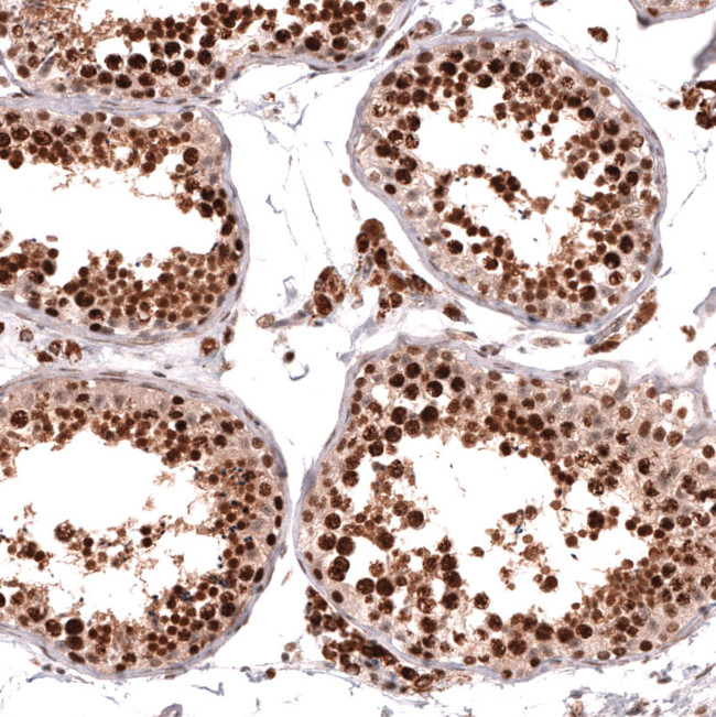 HOXA5 Antibody in Immunohistochemistry (Paraffin) (IHC (P))