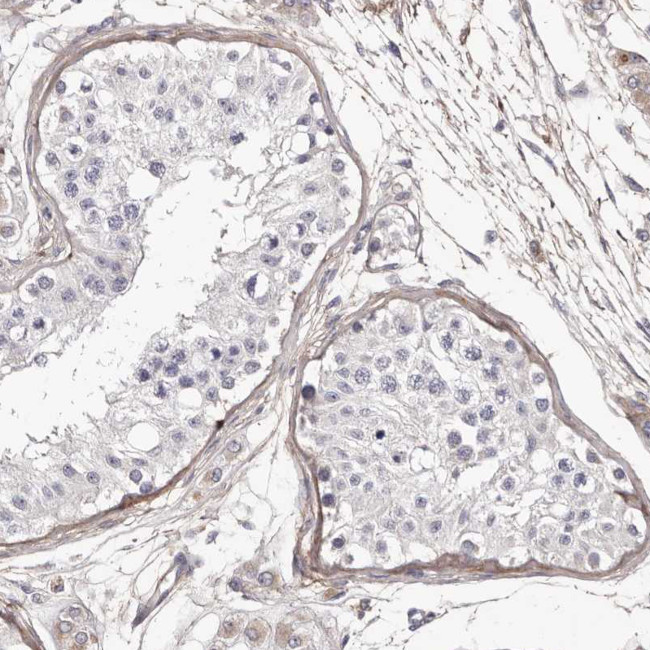 COL6A1 Antibody in Immunohistochemistry (Paraffin) (IHC (P))