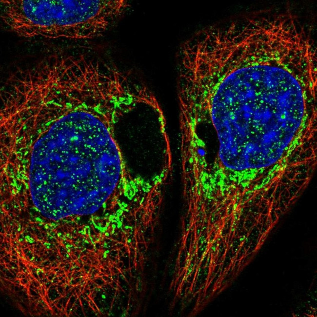 DAP Antibody in Immunocytochemistry (ICC/IF)