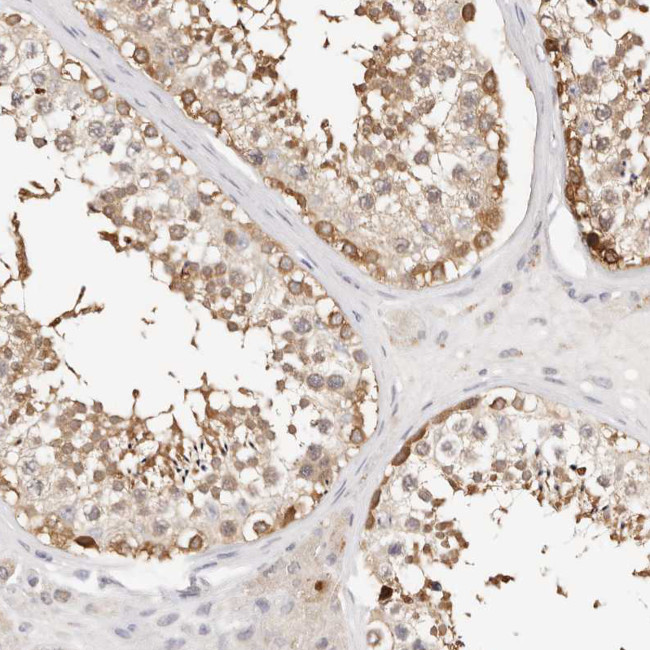 GGPS1 Antibody in Immunohistochemistry (Paraffin) (IHC (P))