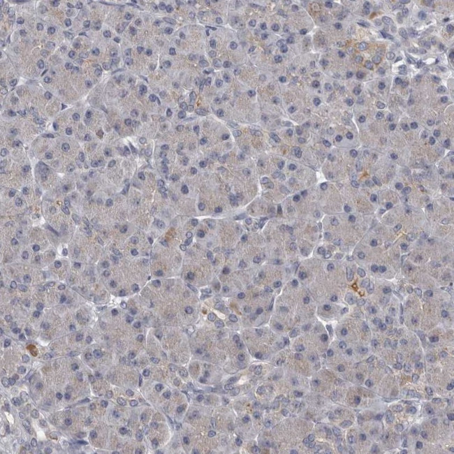 ALDH5A1 Antibody in Immunohistochemistry (Paraffin) (IHC (P))