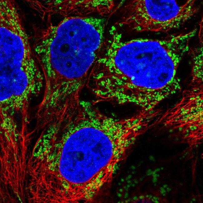 ALDH5A1 Antibody in Immunocytochemistry (ICC/IF)