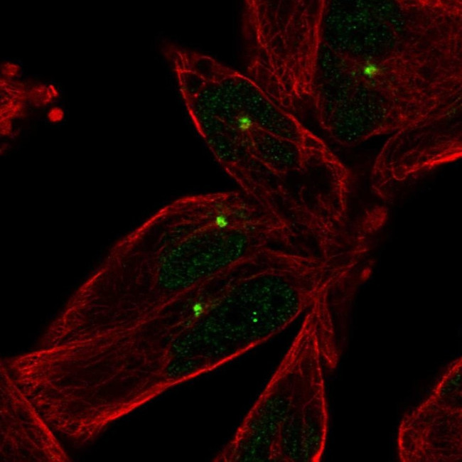 E2F1 Antibody in Immunocytochemistry (ICC/IF)