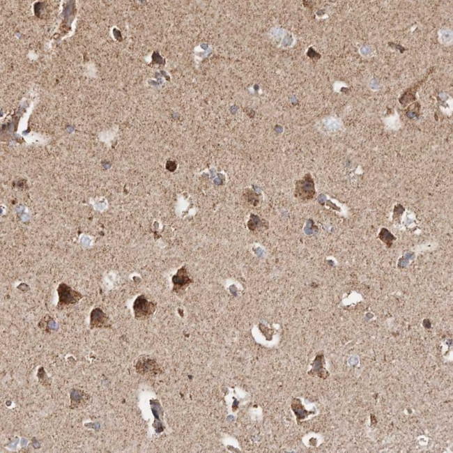 PKA beta Antibody in Immunohistochemistry (Paraffin) (IHC (P))