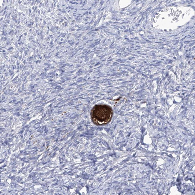 SMS Antibody in Immunohistochemistry (Paraffin) (IHC (P))