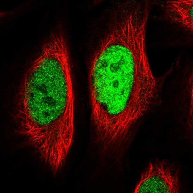 EGR1 Antibody in Immunocytochemistry (ICC/IF)