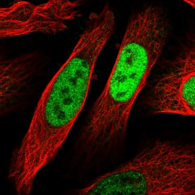 EGR1 Antibody in Immunocytochemistry (ICC/IF)