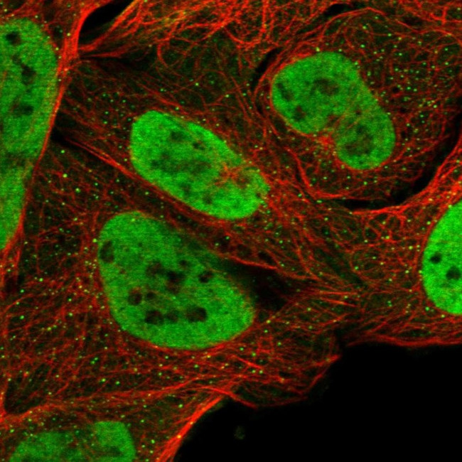 SMARCA2 Antibody in Immunocytochemistry (ICC/IF)