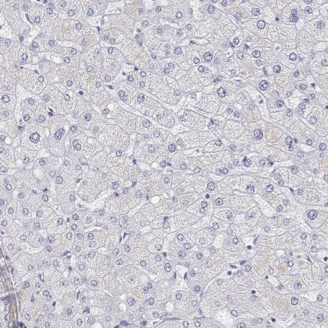 Titin Antibody in Immunohistochemistry (Paraffin) (IHC (P))