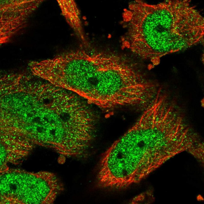 ATF5 Antibody in Immunocytochemistry (ICC/IF)