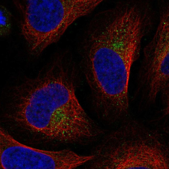 UFD1L Antibody in Immunocytochemistry (ICC/IF)