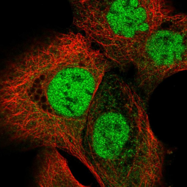 OGT Antibody in Immunocytochemistry (ICC/IF)