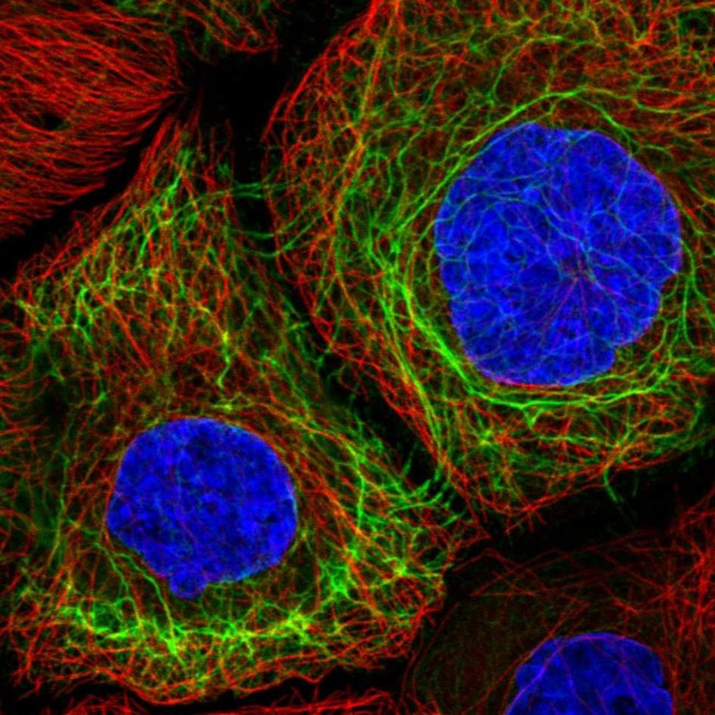 Cytokeratin 13 Antibody in Immunocytochemistry (ICC/IF)