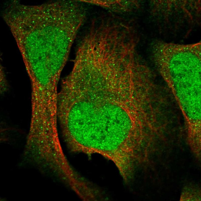 VTA1 Antibody in Immunocytochemistry (ICC/IF)