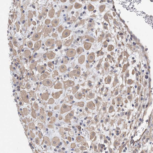 KAO Antibody in Immunohistochemistry (Paraffin) (IHC (P))