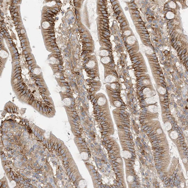 KAO Antibody in Immunohistochemistry (Paraffin) (IHC (P))