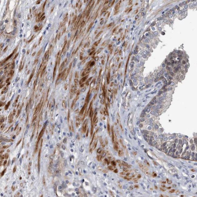 CD133 Antibody in Immunohistochemistry (Paraffin) (IHC (P))