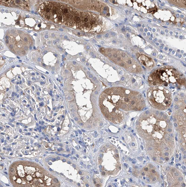 GPT Antibody in Immunohistochemistry (Paraffin) (IHC (P))