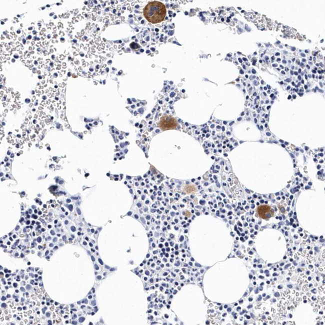 CD41 Antibody in Immunohistochemistry (Paraffin) (IHC (P))