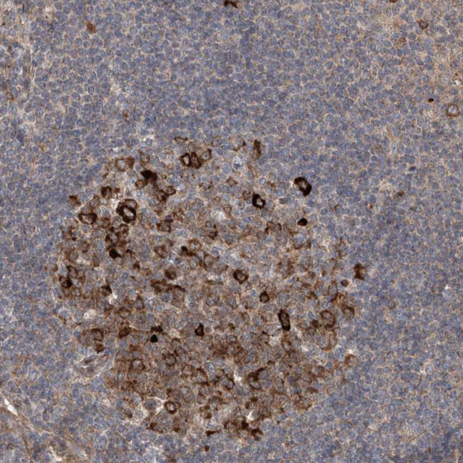 APAF1 Antibody in Immunohistochemistry (Paraffin) (IHC (P))